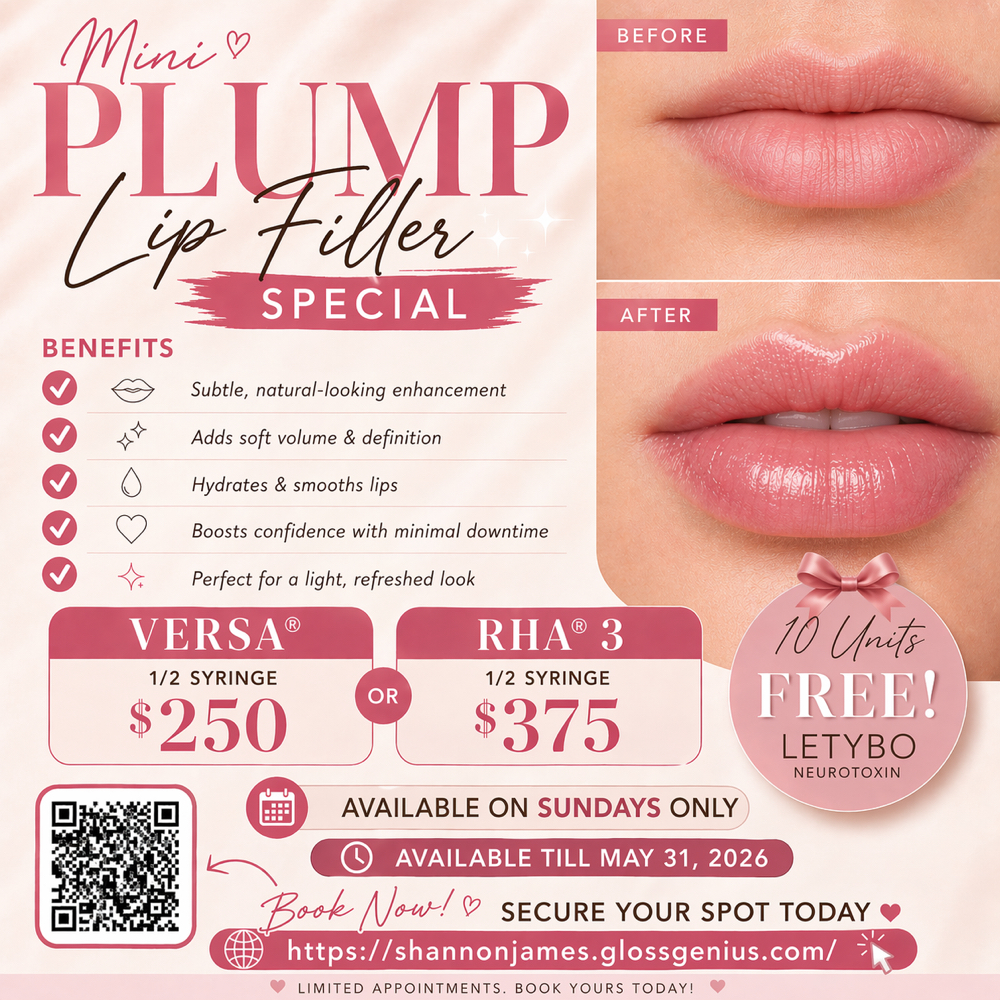 May Promo Lips at Aesthetics By Velvet Master in San Antonio, TX