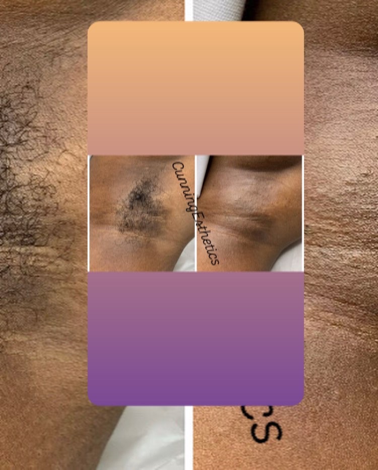Underarm Wax
