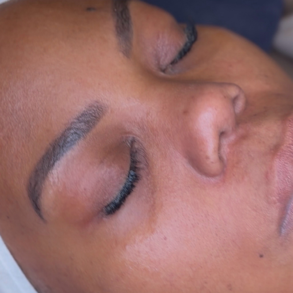 Clarifying Reset Facial at Redeemed Radiance Aesthetics & Cosmetic Injections in San Antonio, TX