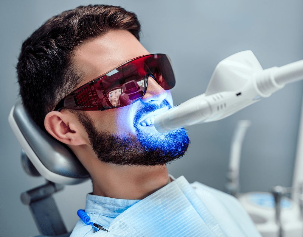 Teeth whitening