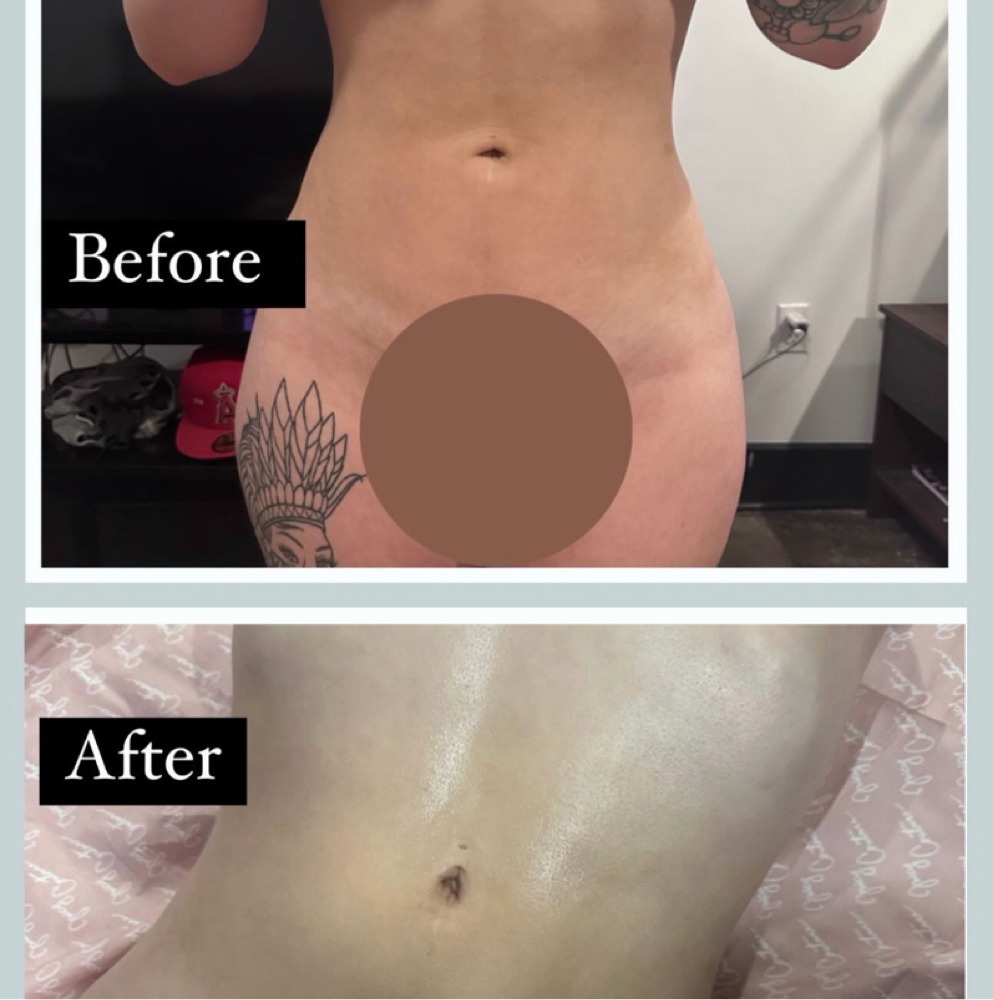 Post Op/ Lymphic Massage Moblie at Nicole Collins-Gray in Virginia Beach Va, VA