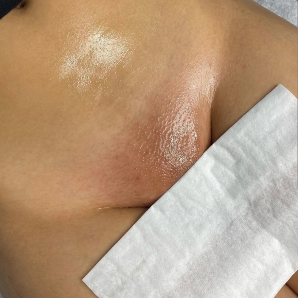 Brazilian at Cherry's Aesthetics in Chillicothe, OH