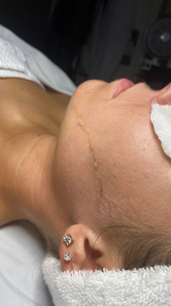 Dermaplane