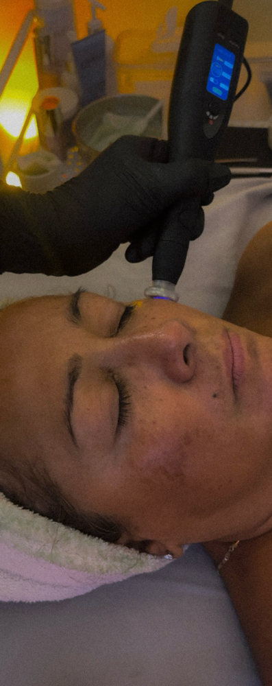 Cold Plasma Facial