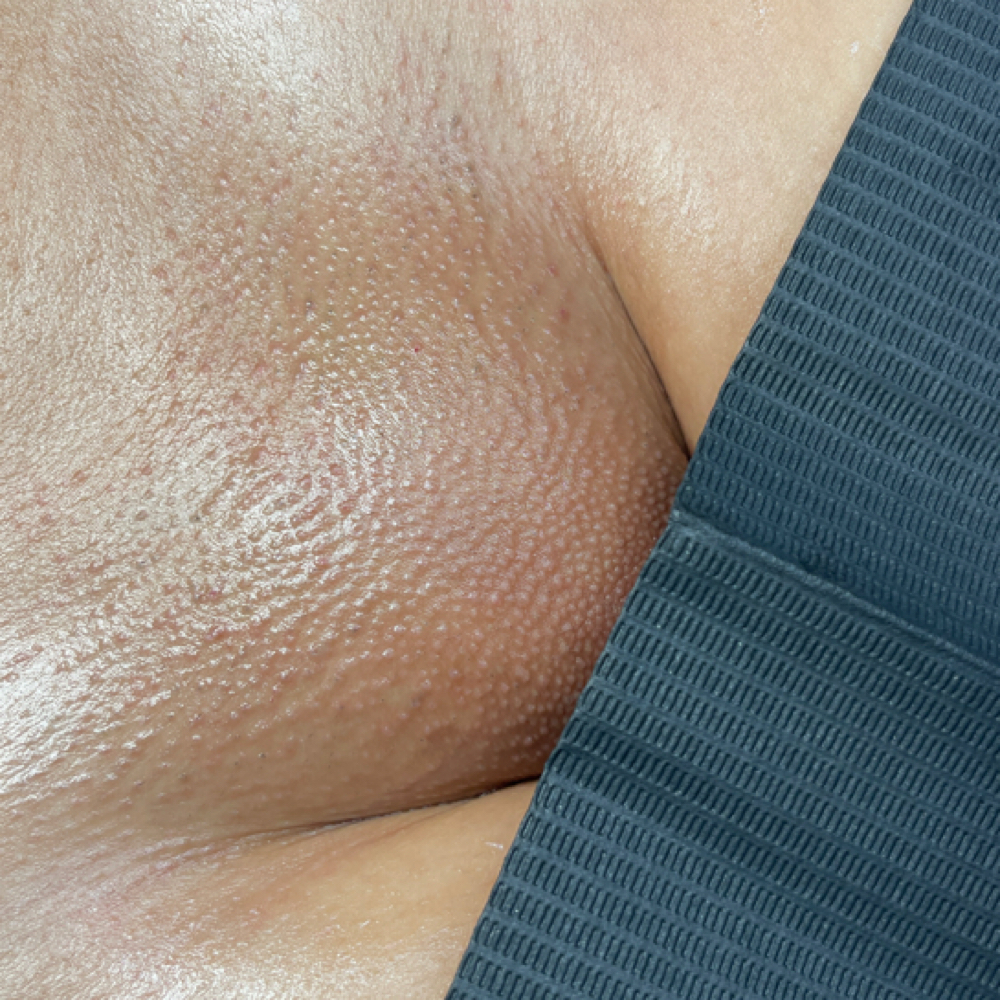 Smooth Starter (3 Month Membership) at Beauty By Yuliana in Orange, CA