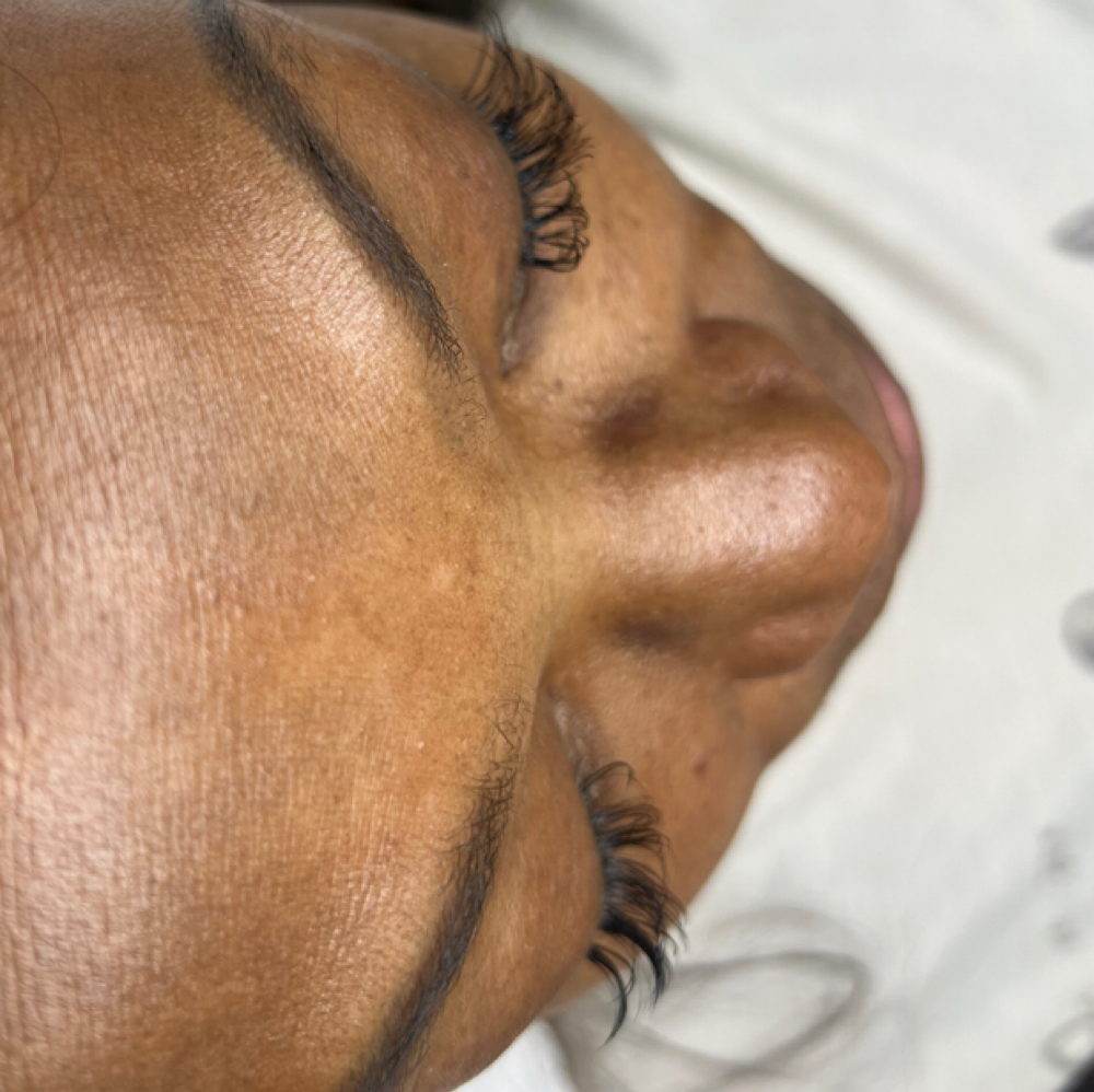 Refill Short Natural (2-3 Weeks) at Radiant Eyes & Aesthetics in Petal, MS