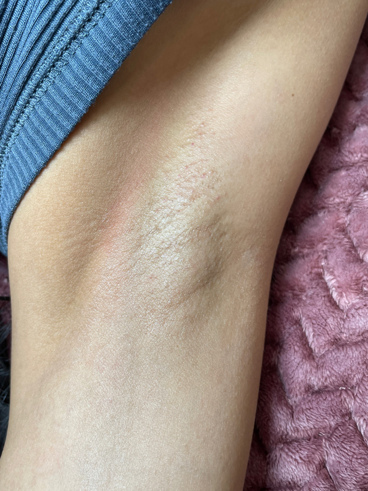 Underarm Waxing