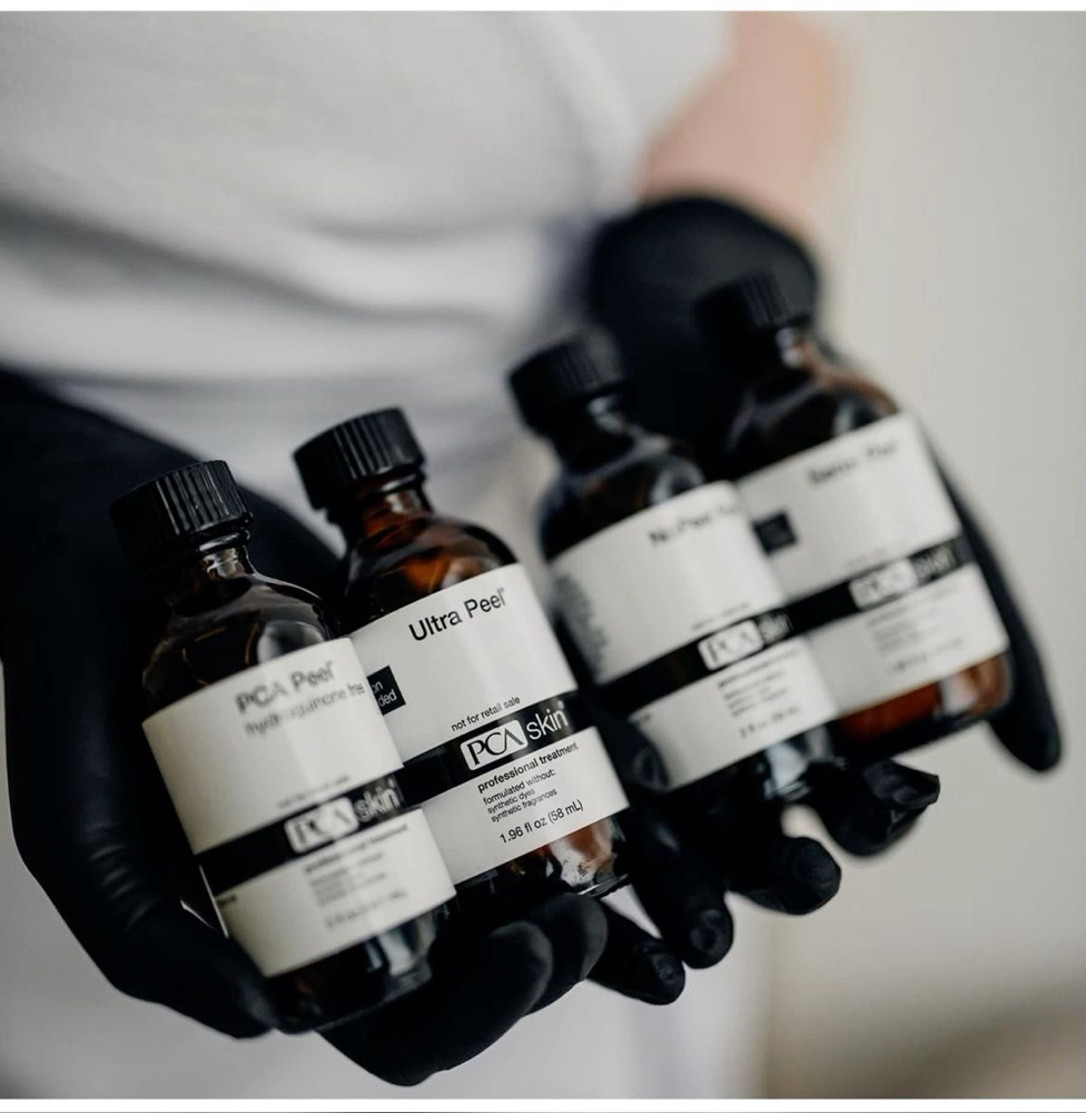 Chemical Peel