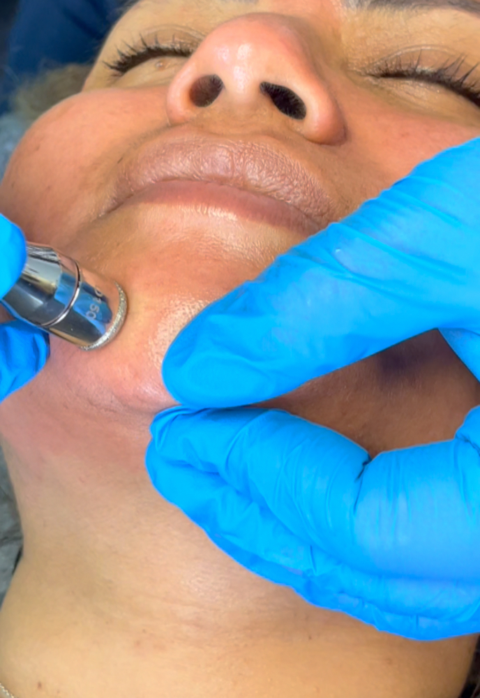 Diamond Glow at Anointed Aesthetics in Pasadena, TX