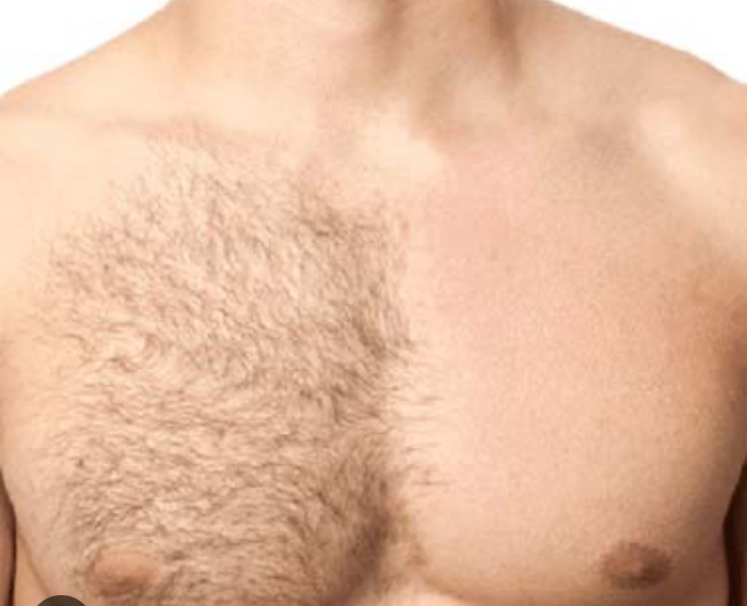 Chest /Back Wax at Royal Glow Experience LLC in Houston, TX