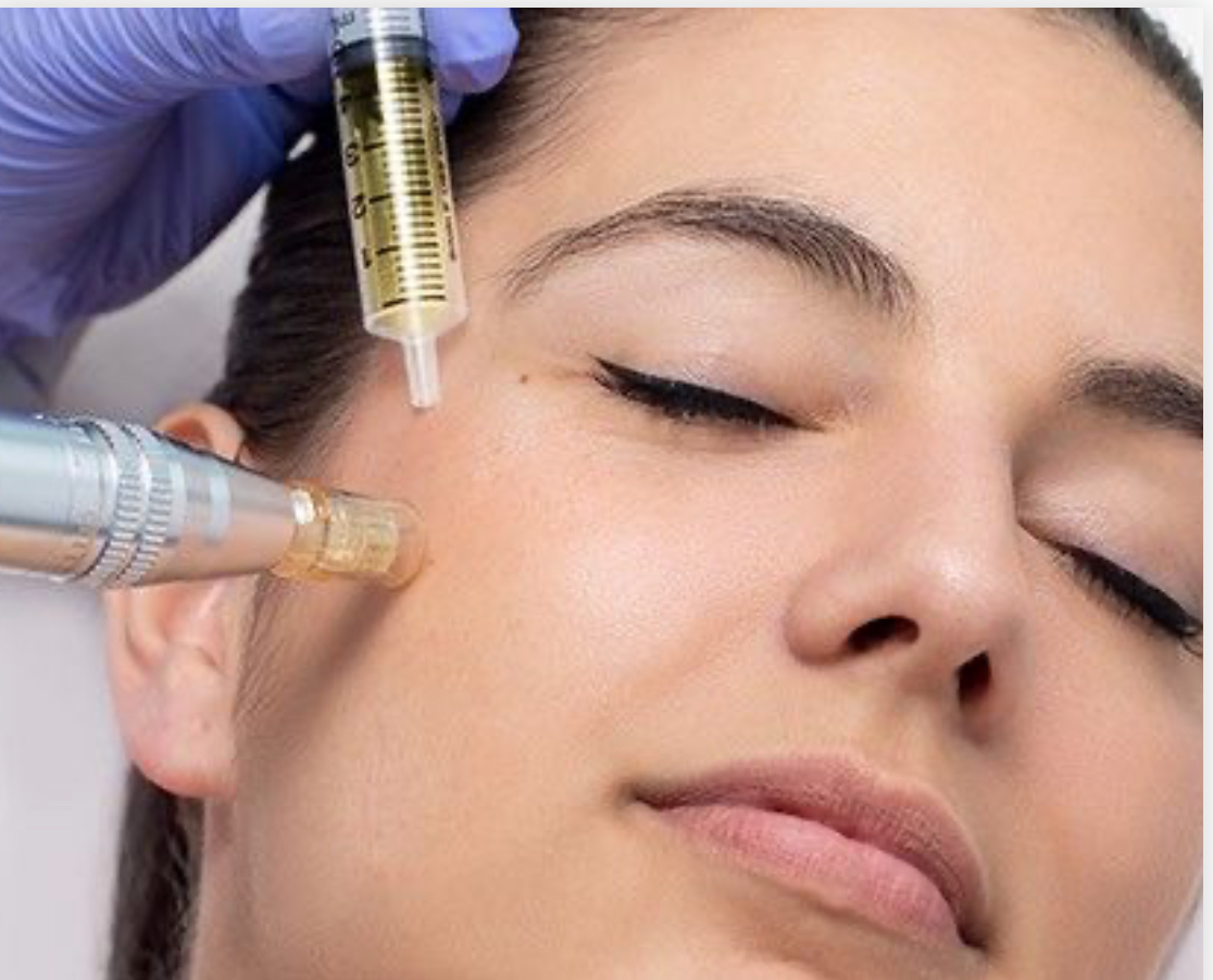 Microneedling Facial