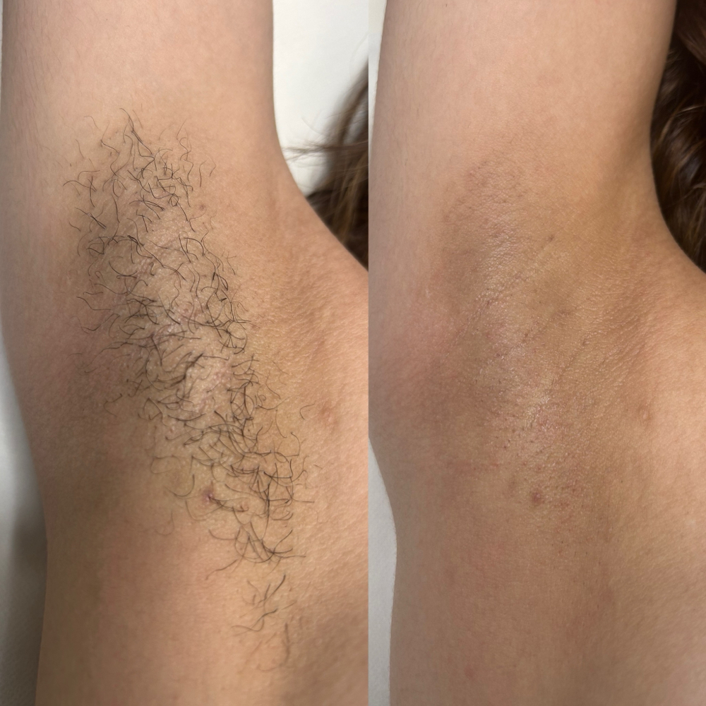 UNDERARM WAX