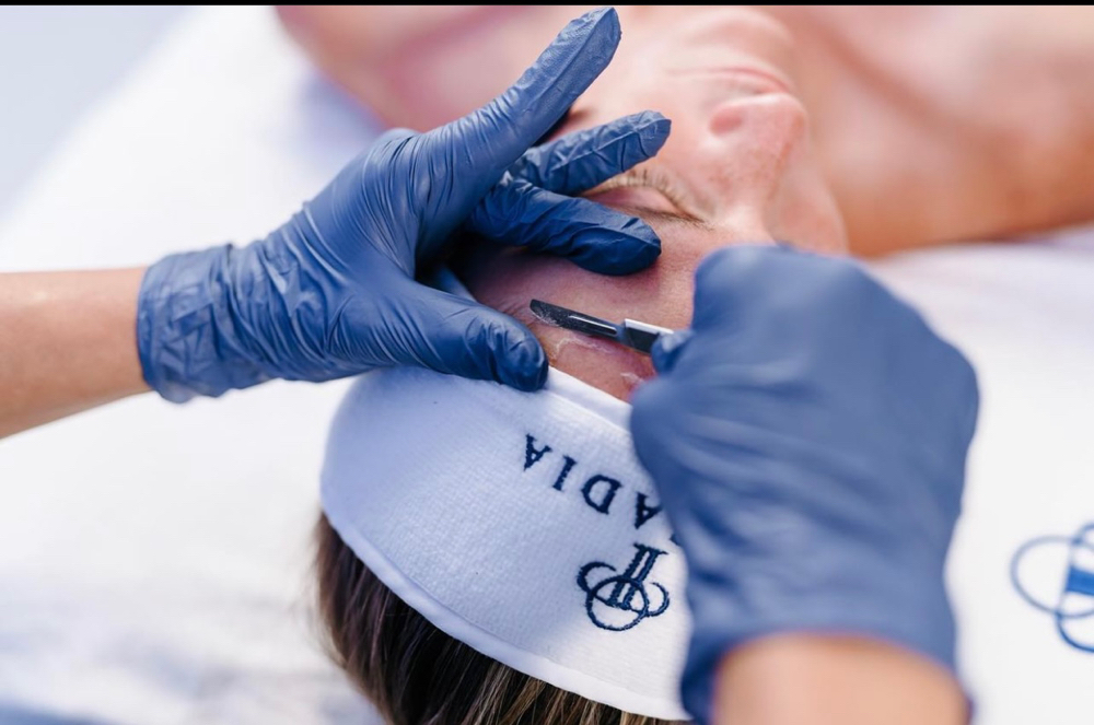 Dermaplaning ADD-On