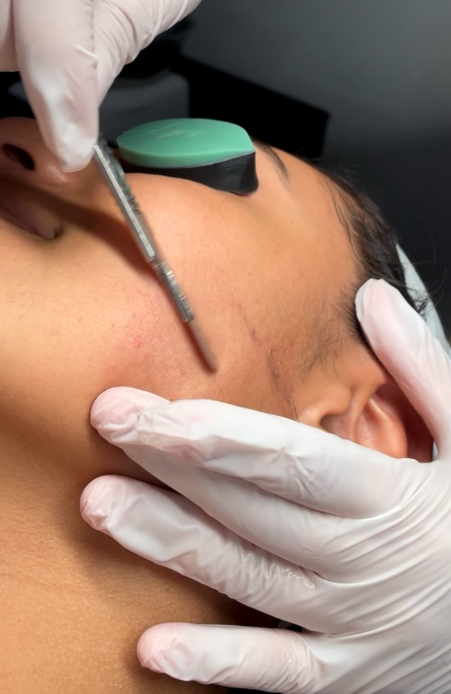 Dermaplaning Facial