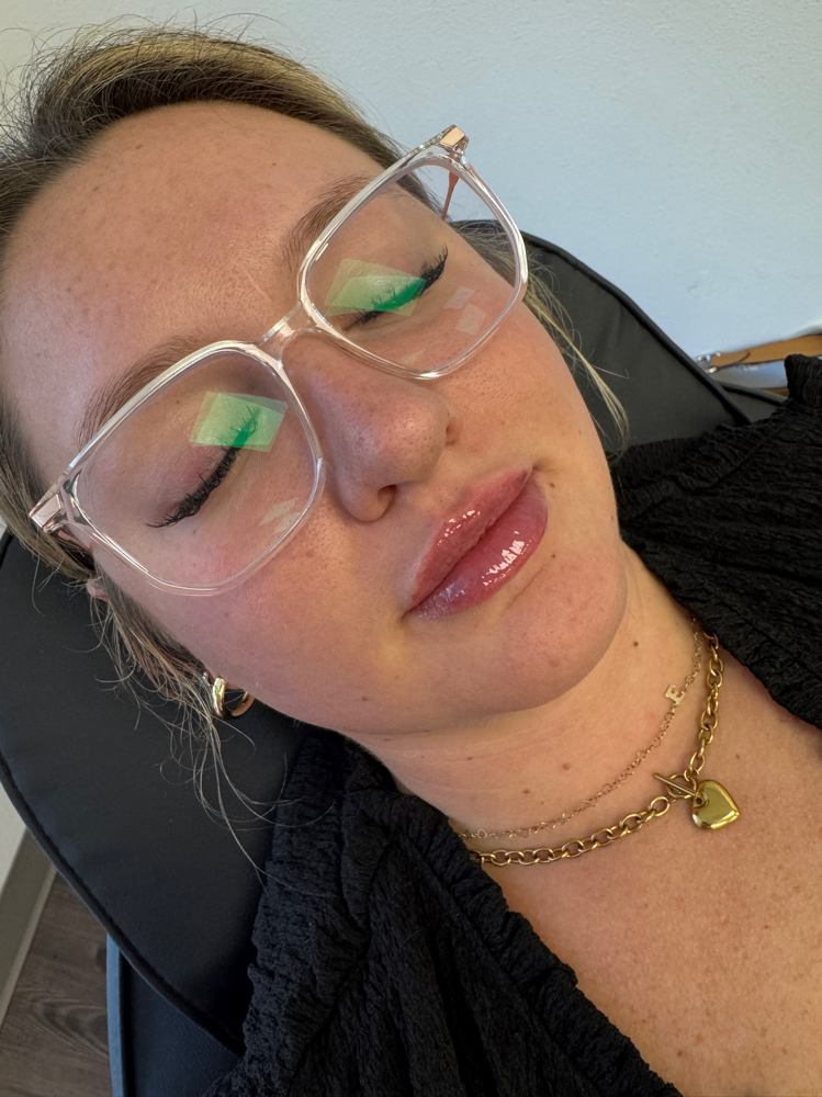 1 Full Syringe at Aesthetic Beauty Bar, LLC By Haley in Tyler, TX