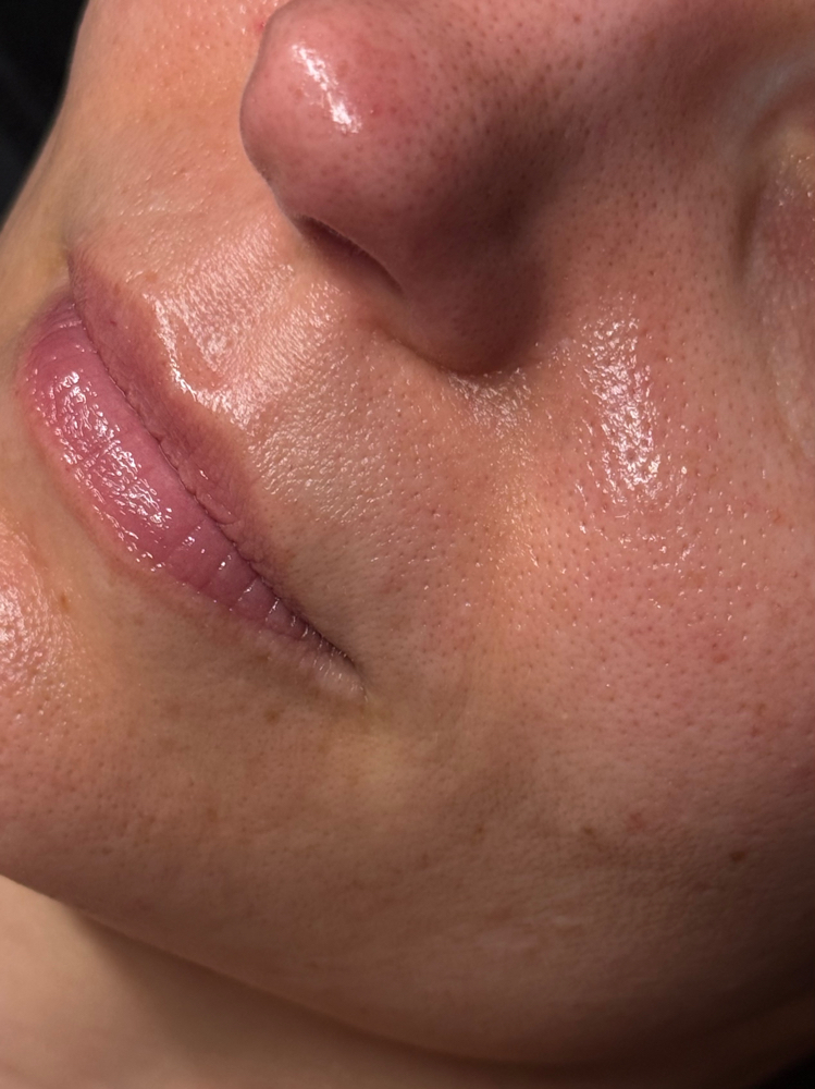 the mini facial at Butler Skin in Sheridan, WY