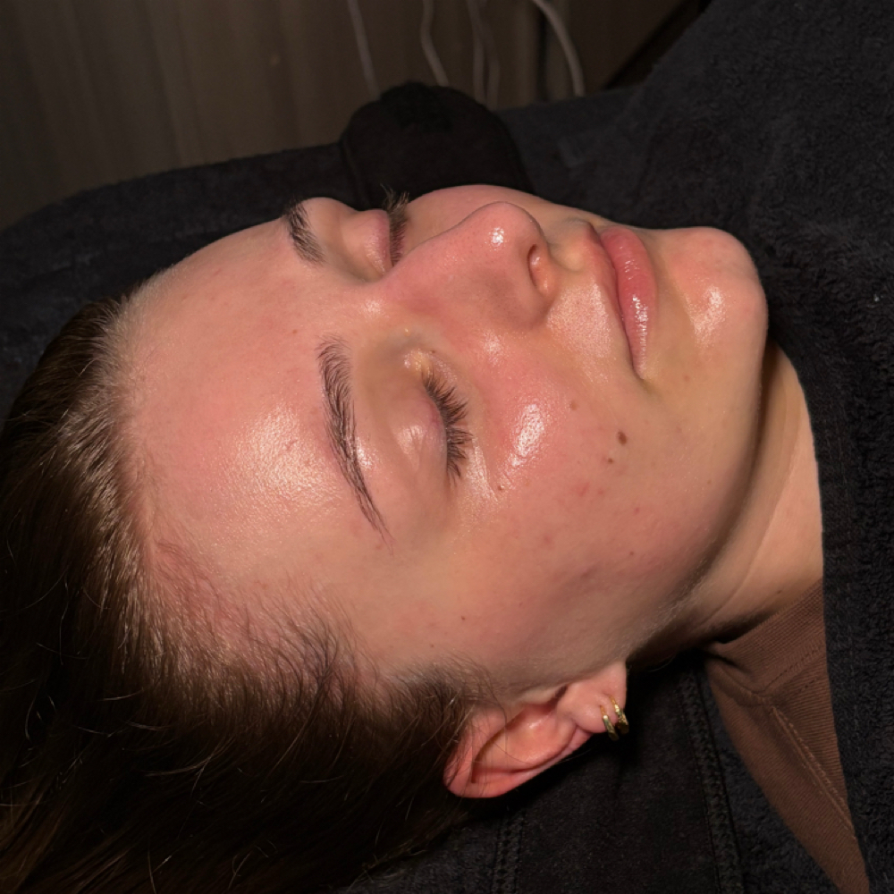 Express Dermaplane Facial at Esthetics By Emmy K in Greenwood, IN
