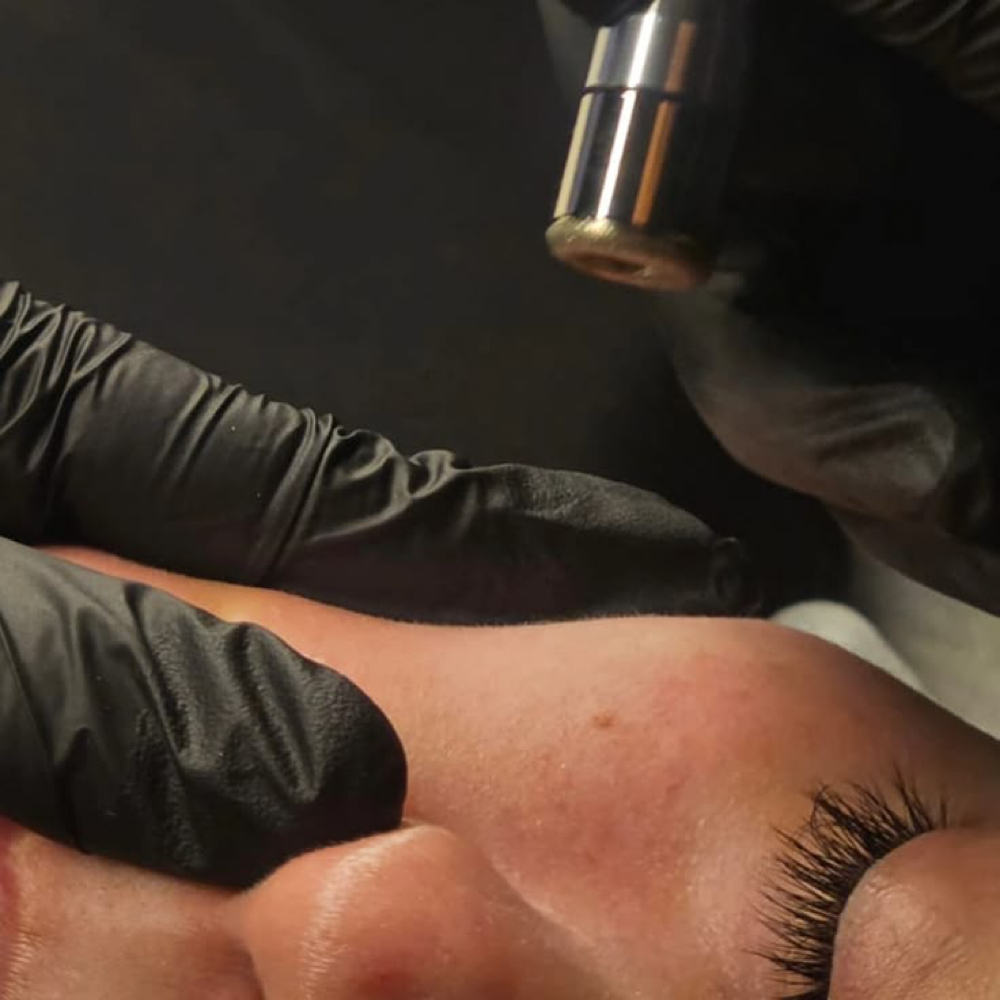 Microdermabrasion + Renewal Facial at YourEstiNala in Mukilteo, WA
