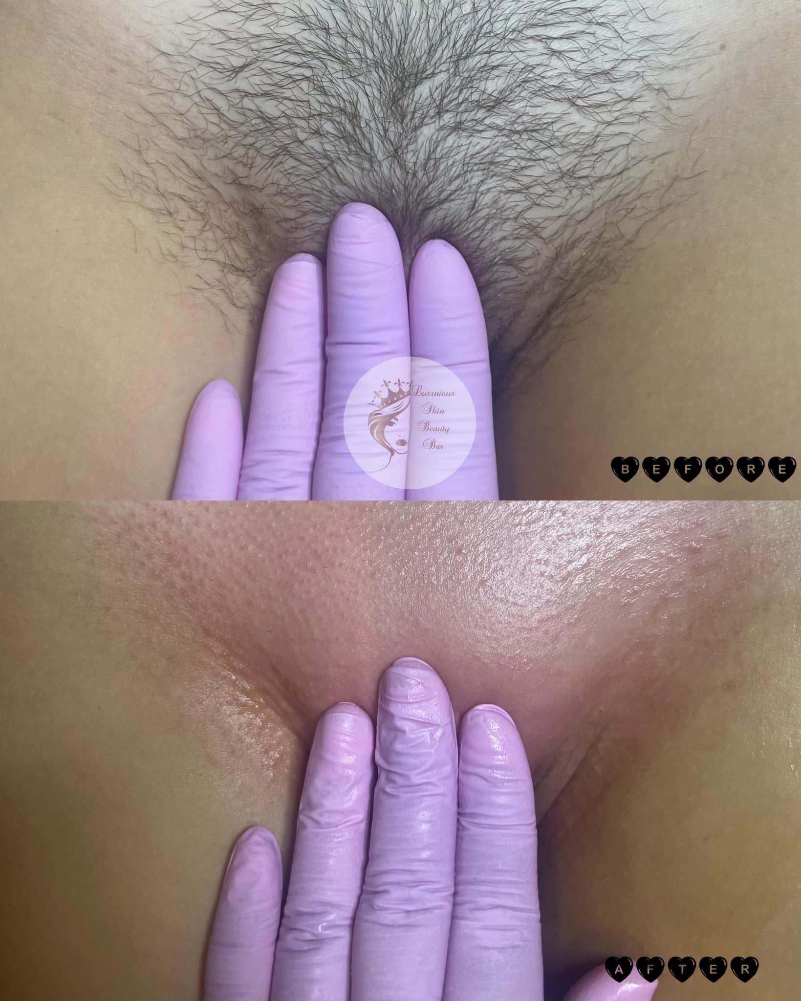 Brazilian wax at Luxurious Skin Beauty Bar in Memphis, TN