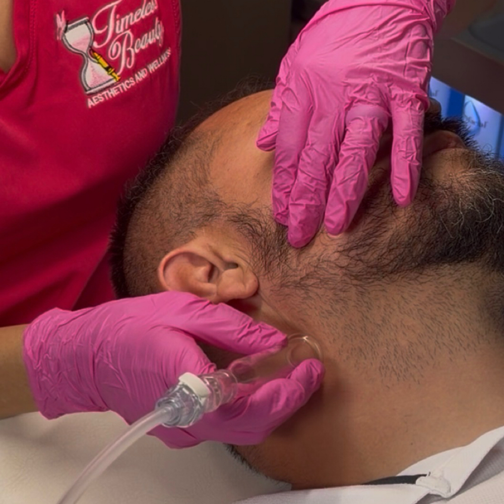 Platinum HydraFacial at Merle Norman of Sharyland Spa and Boutique in Mission, TX