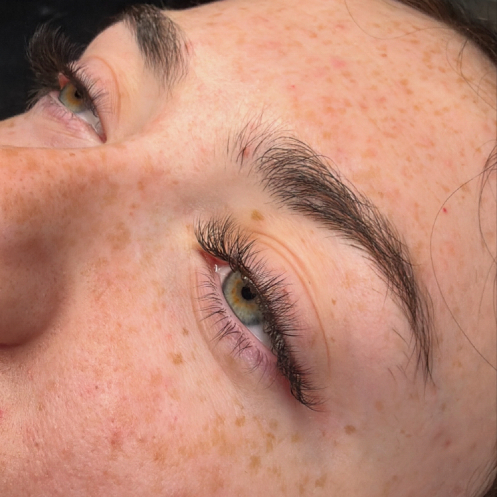 hybrid fill at kenna funkhouser in Terre Haute, IN