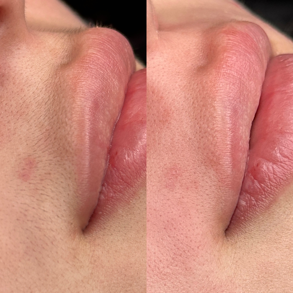 Lip Wax at Rose Beauty Bar | LLC in Lewisville, TX