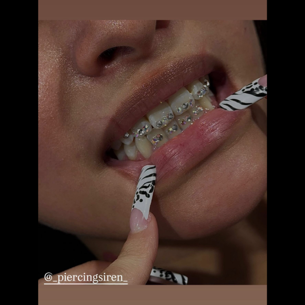 Tooth Gem Consultation at JCR Piercings in Waukegan, IL