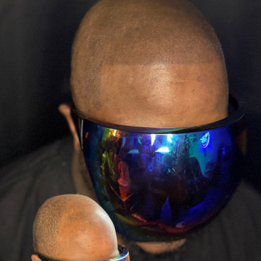 Scalp Micropigmentation (SMP) at PermaBeauD Cosmetic Tattoo in Richmond, VA