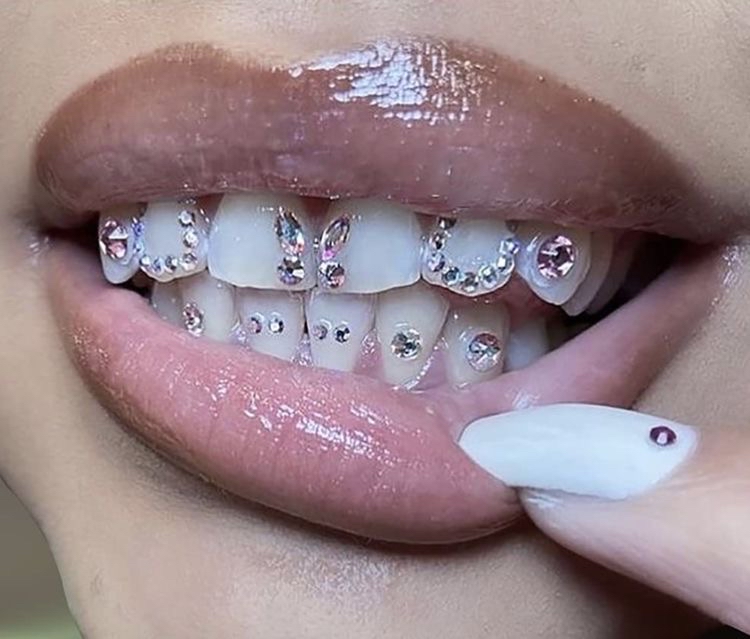 Freestyle Tooth Gem Set