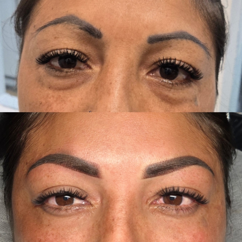 Eyebrow Correction at Cristina  Oliveira
