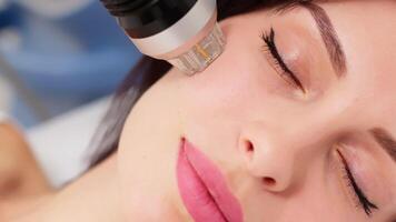 RF Microneedling