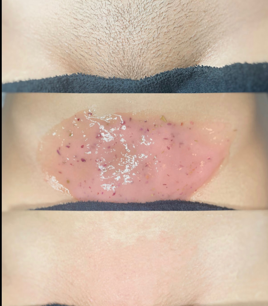 Brazilian Wax