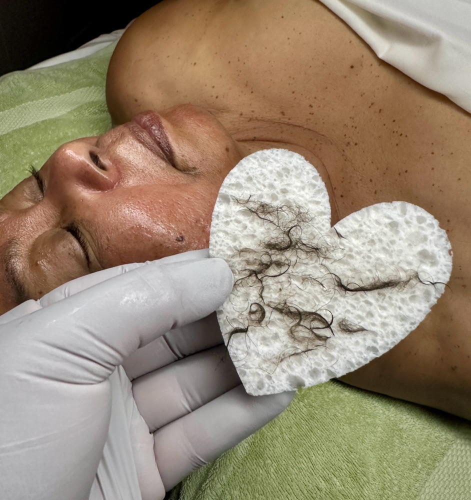 Dermaplaning Facial