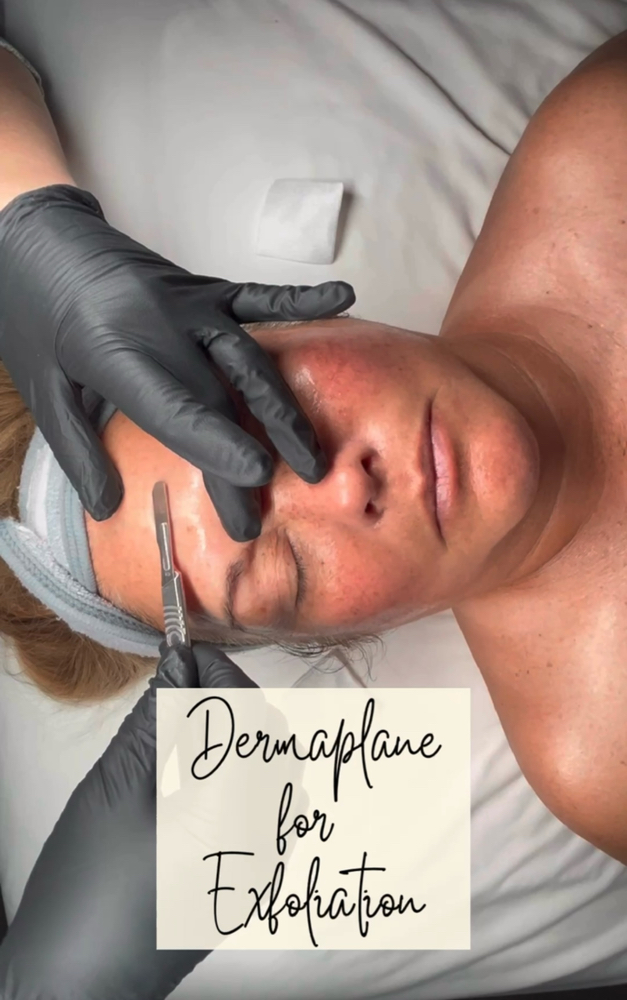 Dermaplane Facial