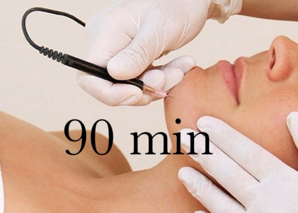 90 Minute Electrolysis Treatment