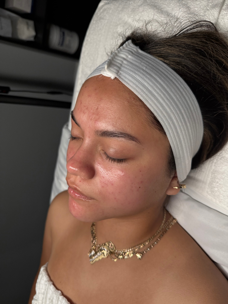 HD Deluxe Facial