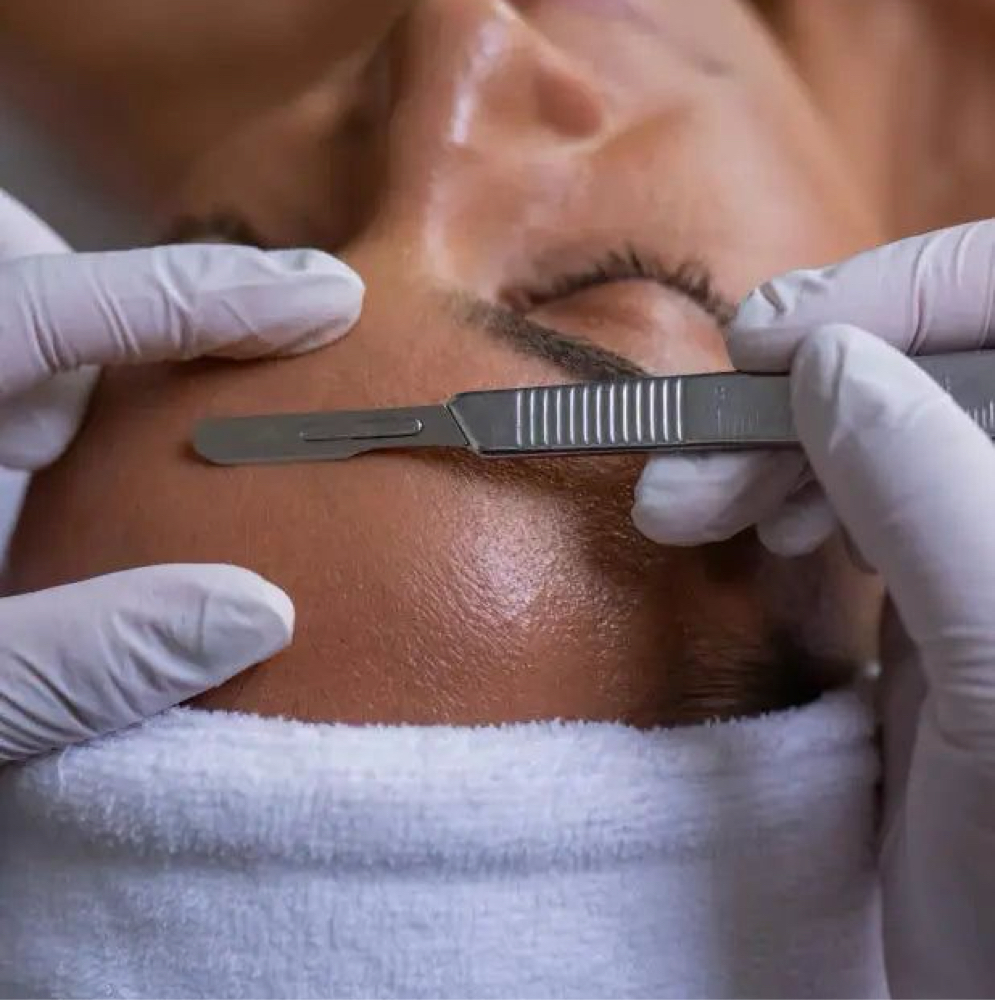 Dermaplanning at Vogetica Beauty Lab (Regina) in Dallas, TX