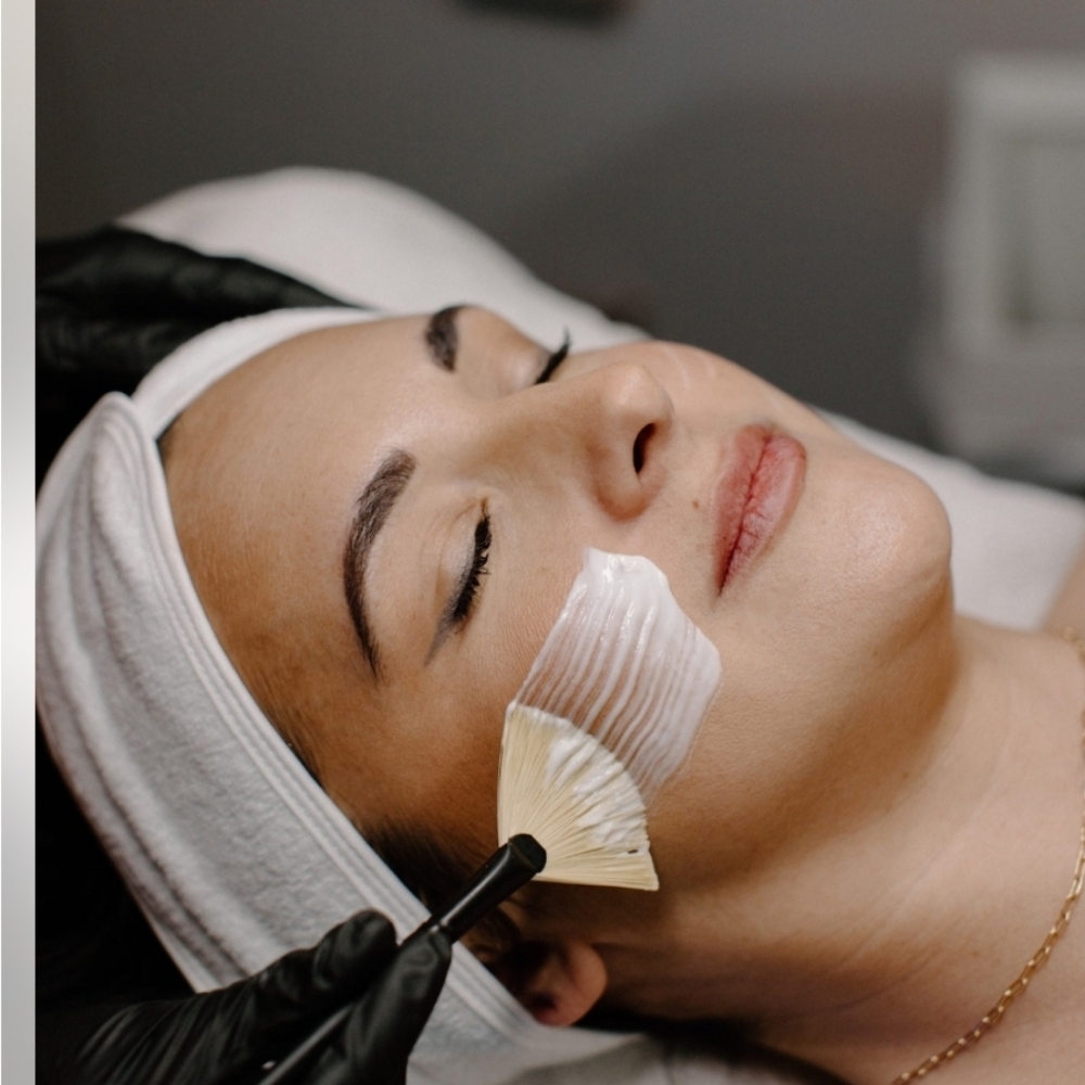 Lira Glow Peel level 3 at let's face it by Ash in Evans, CO