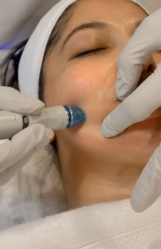 Hydrafacial