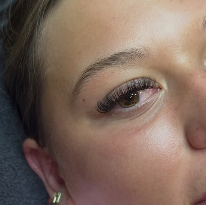 lash removal
