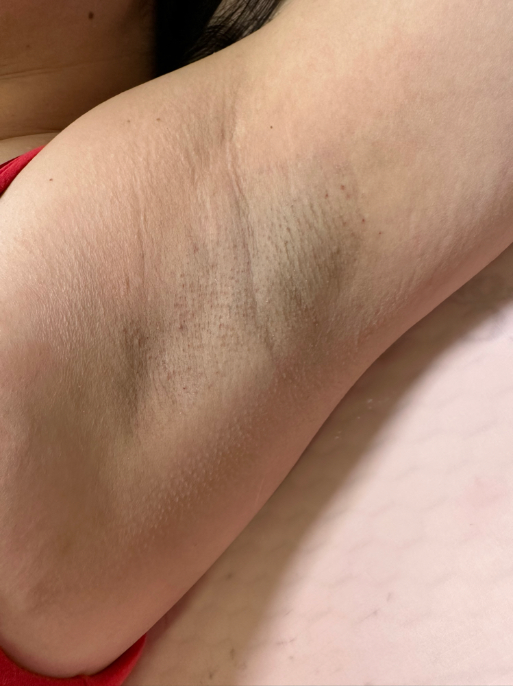 Underarm Wax