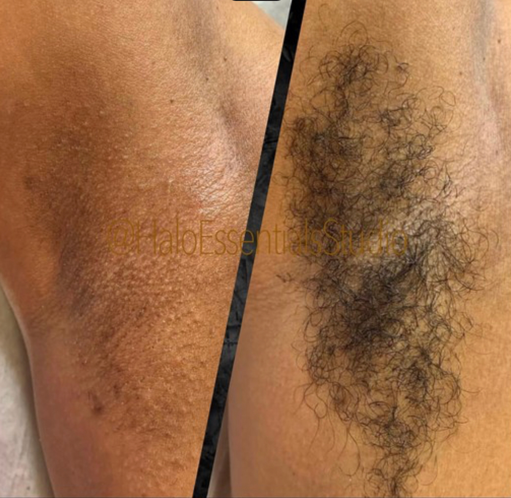 Underarm Bare Wax