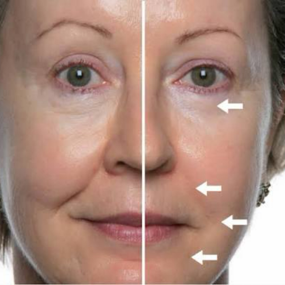 FOUNTAIN OF YOUTH FACIAL at Daisy Nano Brows in Southlake, TX