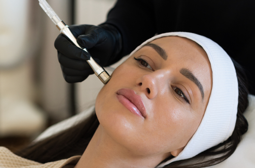 MicroDermabrasion Facial