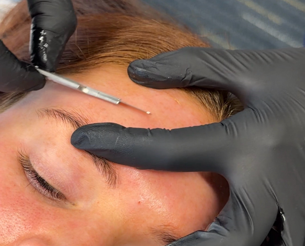 Dermaplane Facial at Sereia Esthetics in Lake Forest, CA