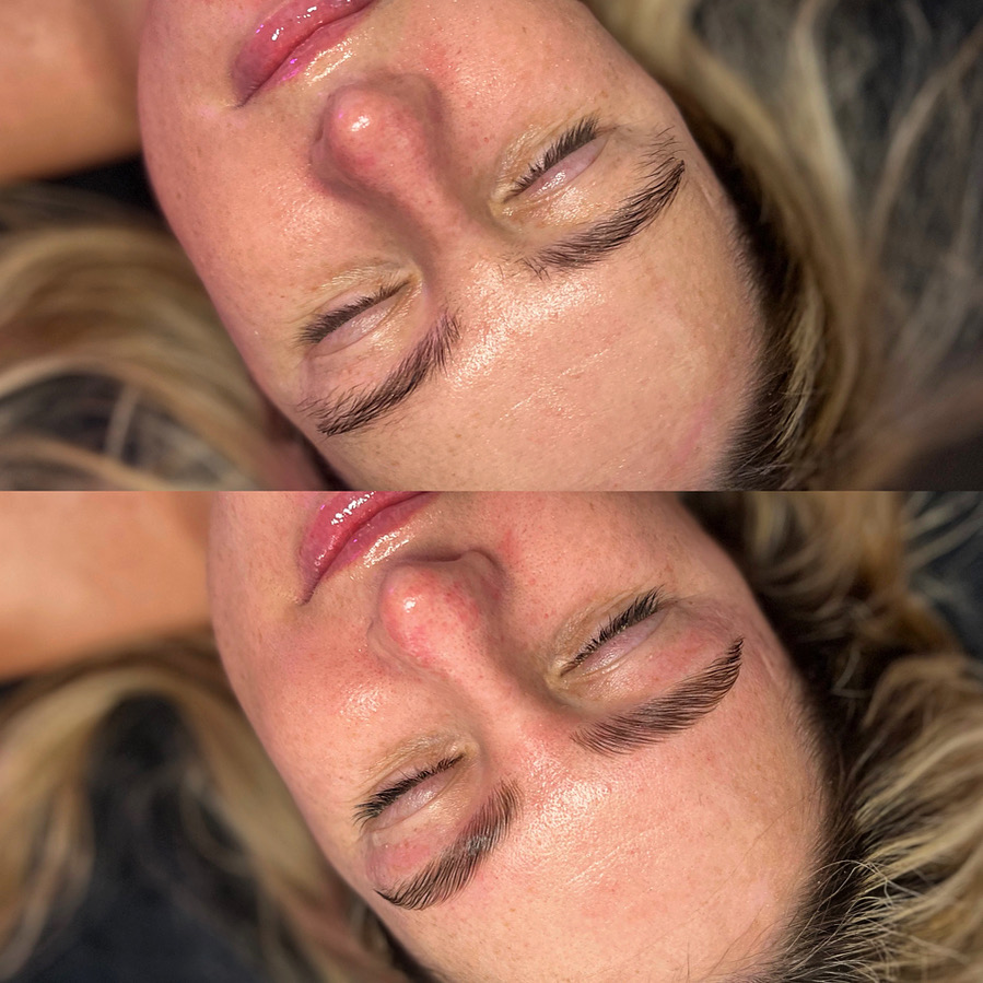 Brow Lamination