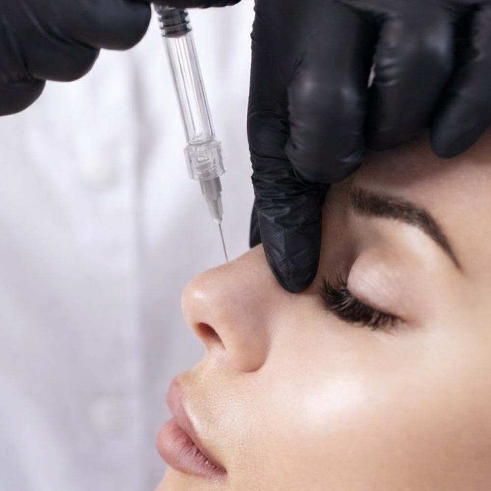 Nose Filler 1ml at Bare Aesthetics ATX in Austin, TX