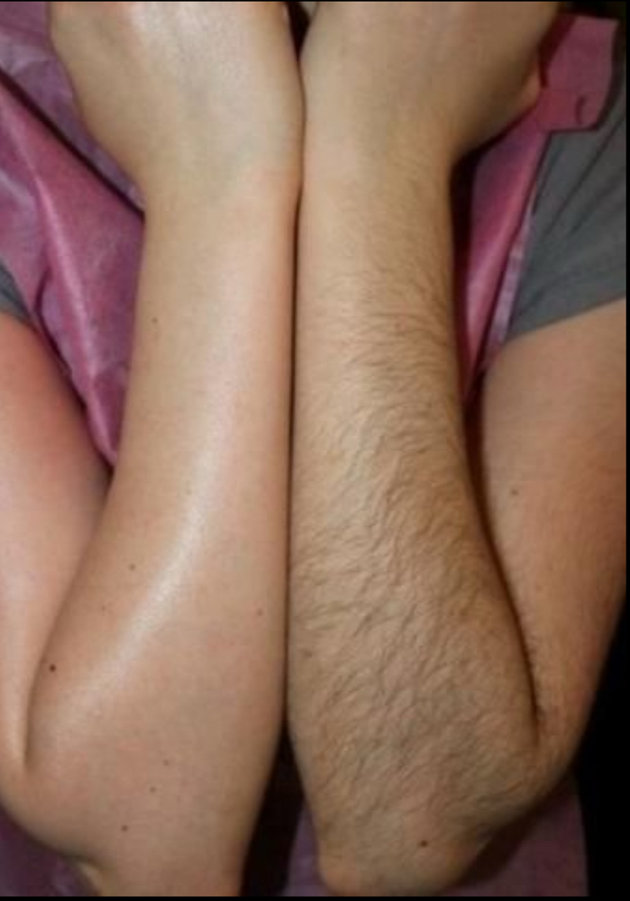 Half Arm Waxing at Belinda’s Brows, LLC in Virginia Beach, VA