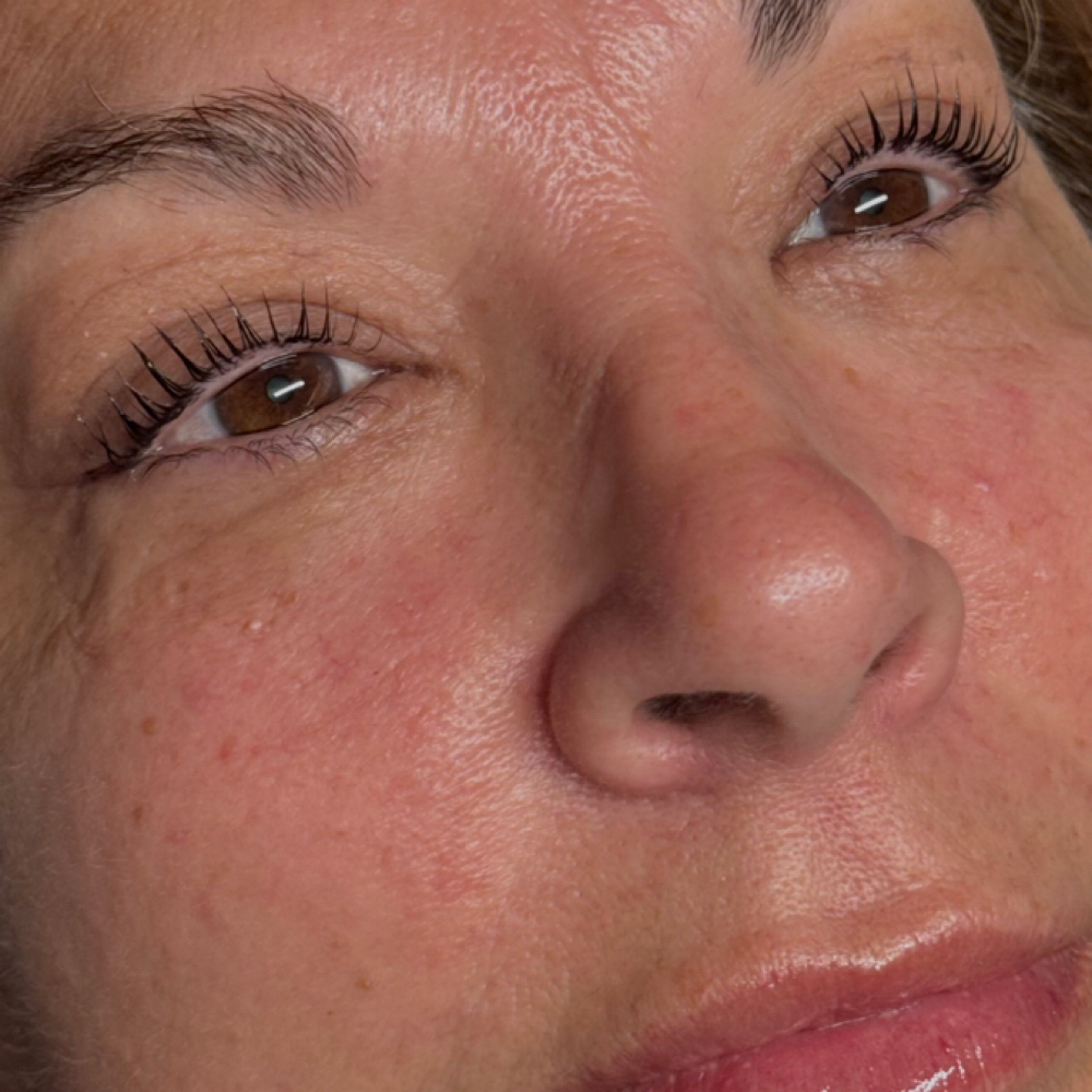 Korean Lash Lift at EstheticsHD in Naples, FL