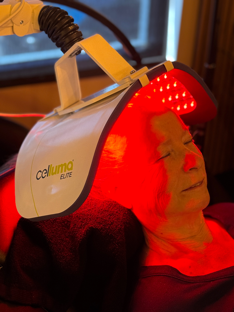 Celluma Hair Restoration